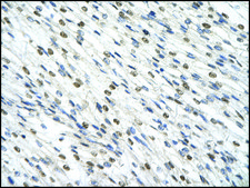 Anti-SMARCD2 antibody produced in rabbit affinity isolated antibody