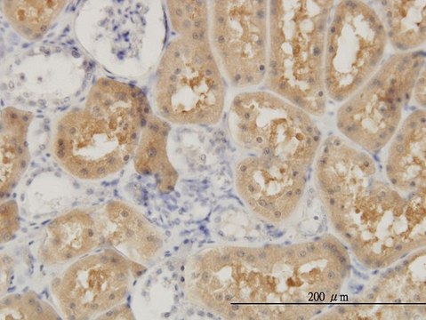 Monoclonal Anti-OCRL antibody produced in mouse clone 4A6, purified immunoglobulin, buffered aqueous solution