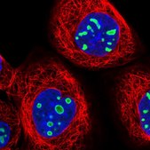 Anti-EBNA1BP2 antibody produced in rabbit Prestige Antibodies® Powered by Atlas Antibodies, affinity isolated antibody, buffered aqueous glycerol solution