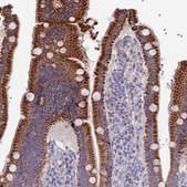 Anti-ETFDH antibody produced in rabbit Prestige Antibodies® Powered by Atlas Antibodies, affinity isolated antibody, buffered aqueous glycerol solution