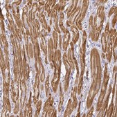 Anti-MYOM2 antibody produced in rabbit Prestige Antibodies® Powered by Atlas Antibodies, affinity isolated antibody, buffered aqueous glycerol solution