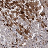 Anti-CRP antibody produced in rabbit Prestige Antibodies&#174; Powered by Atlas Antibodies, affinity isolated antibody, buffered aqueous glycerol solution, Ab1