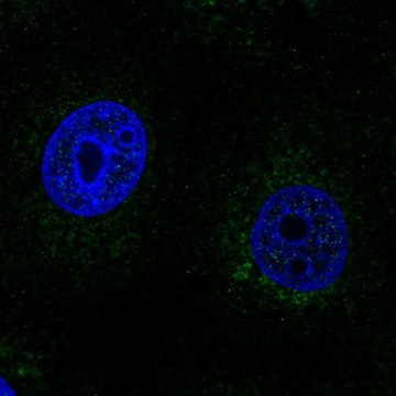 Anti-SCO2 antibody produced in rabbit Prestige Antibodies&#174; Powered by Atlas Antibodies, affinity isolated antibody