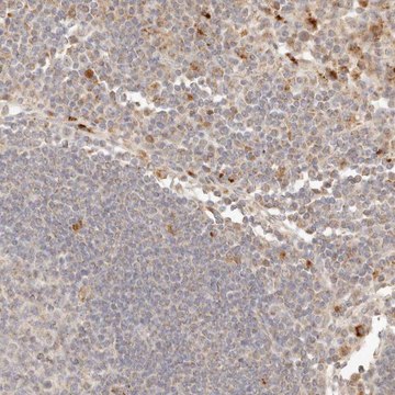 Anti-PTPN22 antibody produced in rabbit Prestige Antibodies&#174; Powered by Atlas Antibodies, affinity isolated antibody, buffered aqueous glycerol solution, ab1