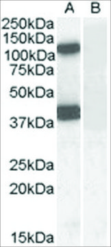 Anti-EPB41L2 /4.1G (AA 593-604) antibody produced in goat affinity isolated antibody, buffered aqueous solution