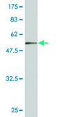 Monoclonal Anti-SET antibody produced in mouse clone M1-F5, purified immunoglobulin, buffered aqueous solution