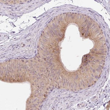 Anti-VPS25 antibody produced in rabbit Prestige Antibodies&#174; Powered by Atlas Antibodies, affinity isolated antibody, buffered aqueous glycerol solution