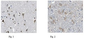 Anti-FYVE Antibody, clone 7F11.1 clone 7F11.1, from mouse