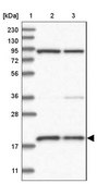 Anti-MRPS18A antibody produced in rabbit Prestige Antibodies® Powered by Atlas Antibodies, affinity isolated antibody, buffered aqueous glycerol solution