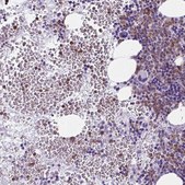 Anti-BPI antibody produced in rabbit Prestige Antibodies® Powered by Atlas Antibodies, affinity isolated antibody, buffered aqueous glycerol solution
