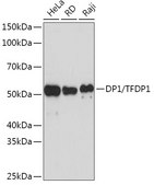 Anti-DP1/TFDP1 antibody produced in rabbit
