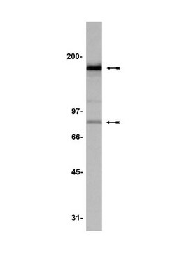 Anti-PTH/PTHrP Receptor Antibody, clone 3D1.1 clone 3D1.1, Upstate&#174;, from mouse