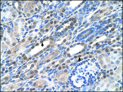 Anti-NOLC1 antibody produced in rabbit IgG fraction of antiserum