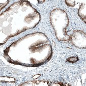 Monoclonal Anti-ITGA2 antibody produced in mouse Prestige Antibodies® Powered by Atlas Antibodies, clone CL7318, purified immunoglobulin, buffered aqueous glycerol solution