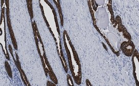 Anti-Cytokeratin-8 Antibody, clone 2D17 ZooMAb® Rabbit Monoclonal recombinant, expressed in HEK 293 cells