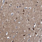 Anti-PHACTR1 antibody produced in rabbit Prestige Antibodies® Powered by Atlas Antibodies, affinity isolated antibody, buffered aqueous glycerol solution, ab1