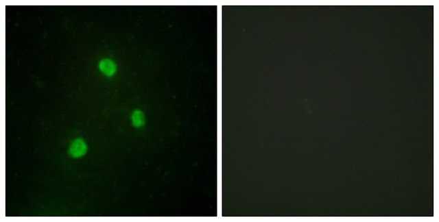 Anti-TBX1, C-Terminal antibody produced in rabbit affinity isolated antibody