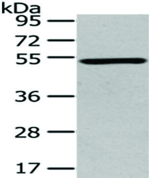 Anti-TSPYL1 affinity isolated antibody