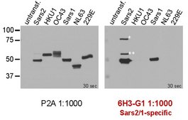 Anti-SARS-CoV-2 nucleocapsid Antibody, clone 6H3-G1