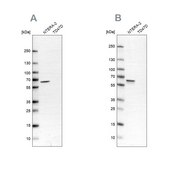 Anti-UPF3B antibody produced in rabbit Ab2, Prestige Antibodies® Powered by Atlas Antibodies, affinity isolated antibody, buffered aqueous glycerol solution