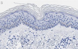 Anti-BMP-7 Antibody, clone 2D15 ZooMAb® Rabbit Monoclonal recombinant, expressed in HEK 293 cells