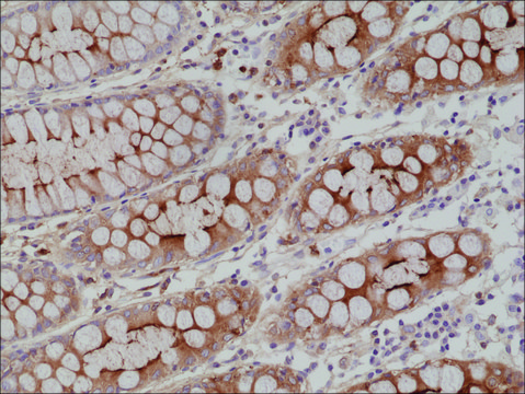 Anti-CEA (CD66e) antibody, Rabbit monoclonal recombinant, expressed in HEK 293 cells, clone RM326, purified immunoglobulin