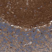 Anti-CORO2B antibody produced in rabbit Prestige Antibodies® Powered by Atlas Antibodies, affinity isolated antibody, buffered aqueous glycerol solution