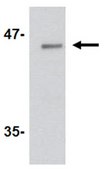 Anti-LASS5 Antibody from rabbit, purified by affinity chromatography