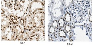 Anti-Acetylated Nucleophosmin Antibody, clone 31M1 clone 31M1, from mouse