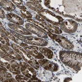 Anti-DPM3 antibody produced in rabbit Prestige Antibodies® Powered by Atlas Antibodies, affinity isolated antibody, buffered aqueous glycerol solution