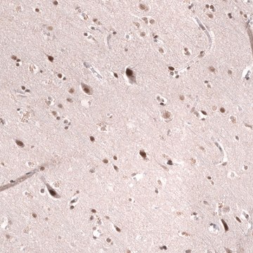 Monoclonal Anti-Smarcb1 Antibody Produced In Mouse Prestige Antibodies® Powered by Atlas Antibodies, clone CL14017, affinity isolated antibody, buffered aqueous glycerol solution