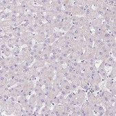 Anti-TRIP13 antibody produced in rabbit Prestige Antibodies® Powered by Atlas Antibodies, affinity isolated antibody, buffered aqueous glycerol solution