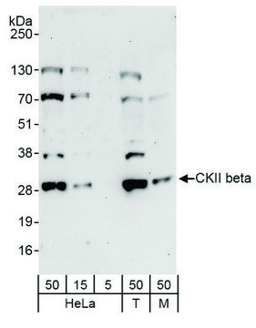 Rabbit anti-CKII beta Antibody, Affinity Purified Powered by Bethyl Laboratories, Inc.