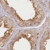 Anti-KATNB1 antibody produced in rabbit Prestige Antibodies® Powered by Atlas Antibodies, affinity isolated antibody, buffered aqueous glycerol solution