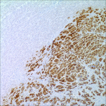 Glypican-3 (1G12) Mouse Monoclonal Antibody