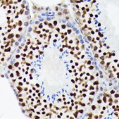 Anti-EWSR1 antibody produced in rabbit
