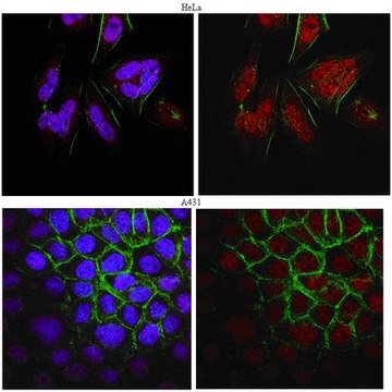 抗-BRCA1抗体，克隆MS13 clone MS13, from mouse