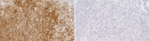Anti-ALPL Antibody, clone 1D10 ZooMAb® Rabbit Monoclonal recombinant, expressed in HEK 293 cells