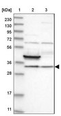 Anti-FAM189A2 antibody produced in rabbit Prestige Antibodies® Powered by Atlas Antibodies, affinity isolated antibody, buffered aqueous glycerol solution