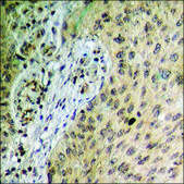 Anti-phospho-HER2 (pTyr877) antibody produced in rabbit affinity isolated antibody