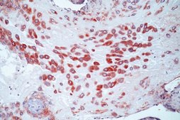 Anti-MMP-2 Proform Antibody, NT, clone CA-4001 clone CA-4001, Chemicon®, from mouse