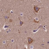 Anti-SPRYD3 antibody produced in rabbit Prestige Antibodies® Powered by Atlas Antibodies, affinity isolated antibody, buffered aqueous glycerol solution