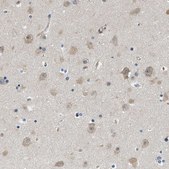 Anti-CSDE1 antibody produced in rabbit Prestige Antibodies® Powered by Atlas Antibodies, affinity isolated antibody, buffered aqueous glycerol solution