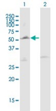 Anti-LPL antibody produced in mouse purified immunoglobulin, buffered aqueous solution