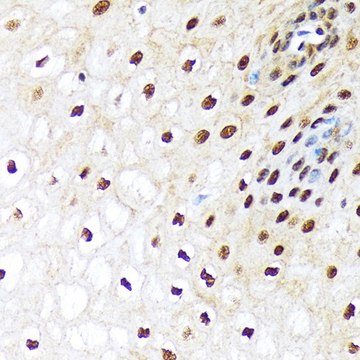 Anti-UBA1 antibody produced in rabbit