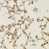 Anti-S100A4 antibody produced in rabbit