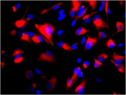 Anti-Nestin Antibody, clone 10C2, Cy3 conjugate clone 10C2, from mouse, CY3 conjugate