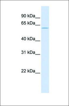 Anti-ZNF703 (ab1) antibody produced in rabbit affinity isolated antibody