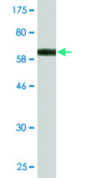 Monoclonal Anti-HGD antibody produced in mouse clone 1F1, purified immunoglobulin, buffered aqueous solution