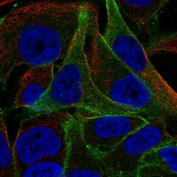 Anti-Ppfibp1 Antibody Produced In Rabbit Prestige Antibodies&#174; Powered by Atlas Antibodies, affinity isolated antibody, buffered aqueous glycerol solution